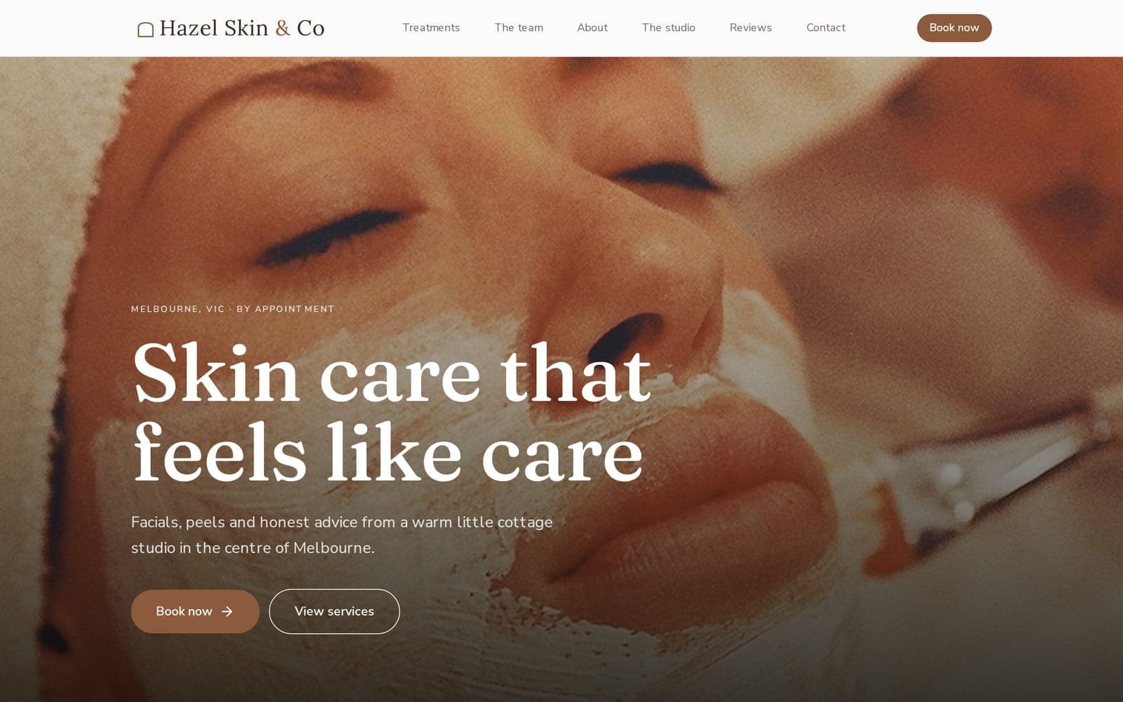 benotely.com/hazel-skin - Home page
